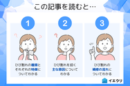 この記事を読むとわかること